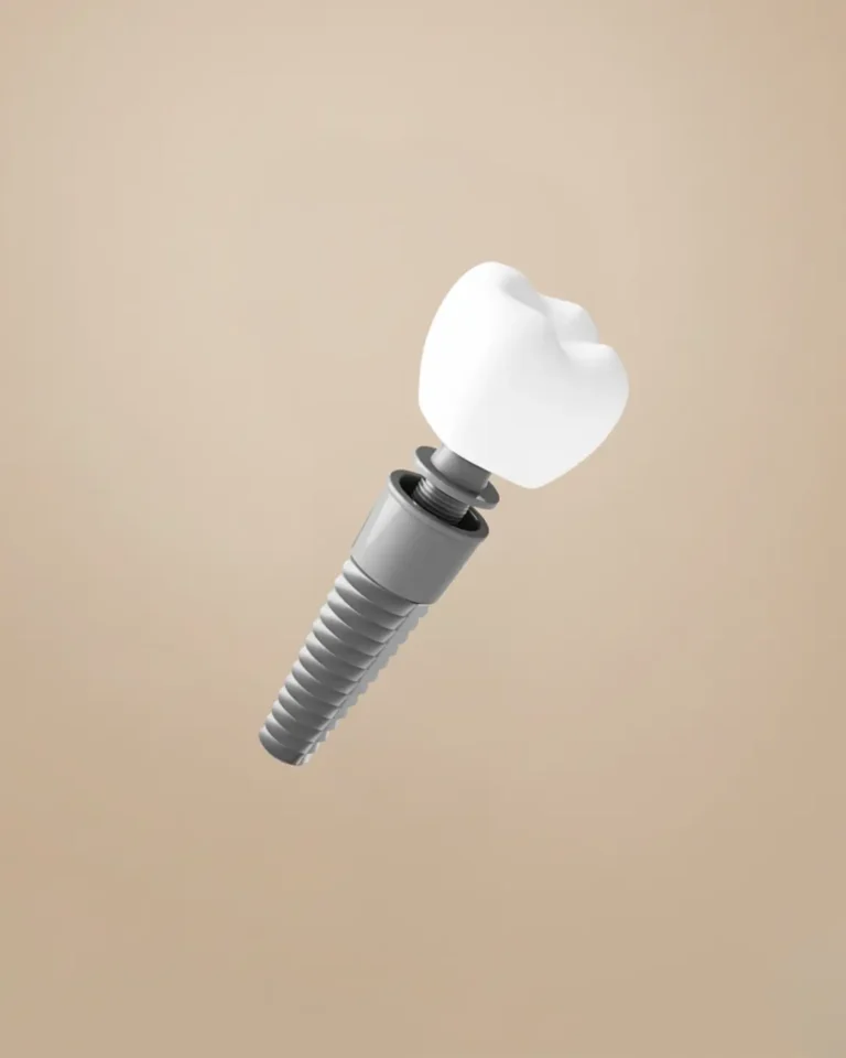 Single Tooth Implant Image description